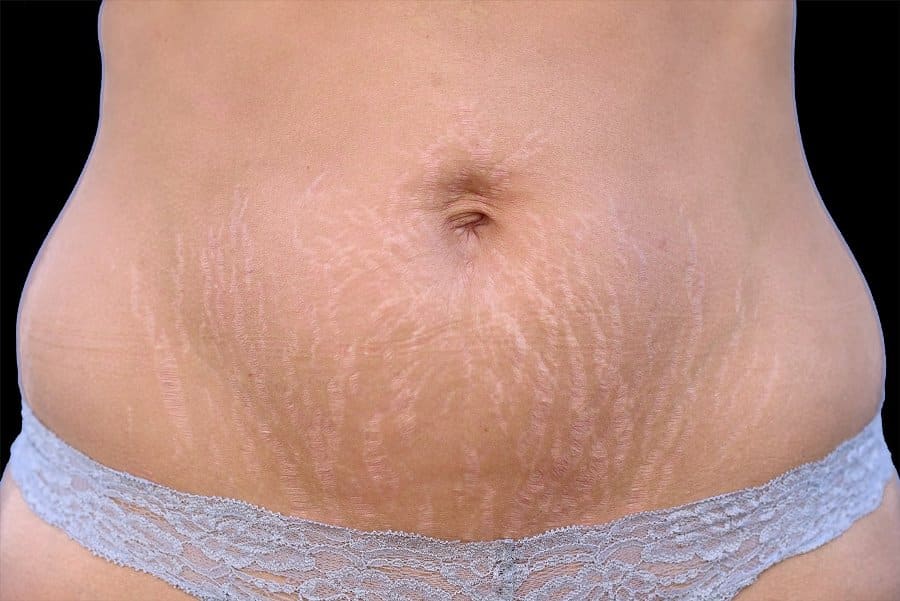 Lose-Skin-1-Sculptology