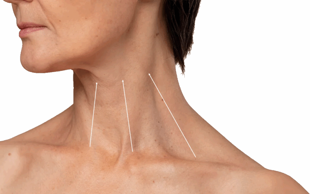 Injectables aereas for the neck