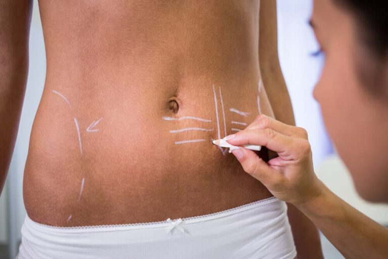 CoolSculpting for Post Injury Rehabilitation Supporting Recovery with Non-Invasive Procedures