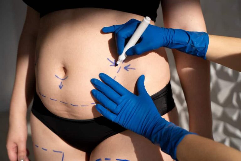 CoolSculpting-for-Mommy-Makeovers_-Regaining-Confidence