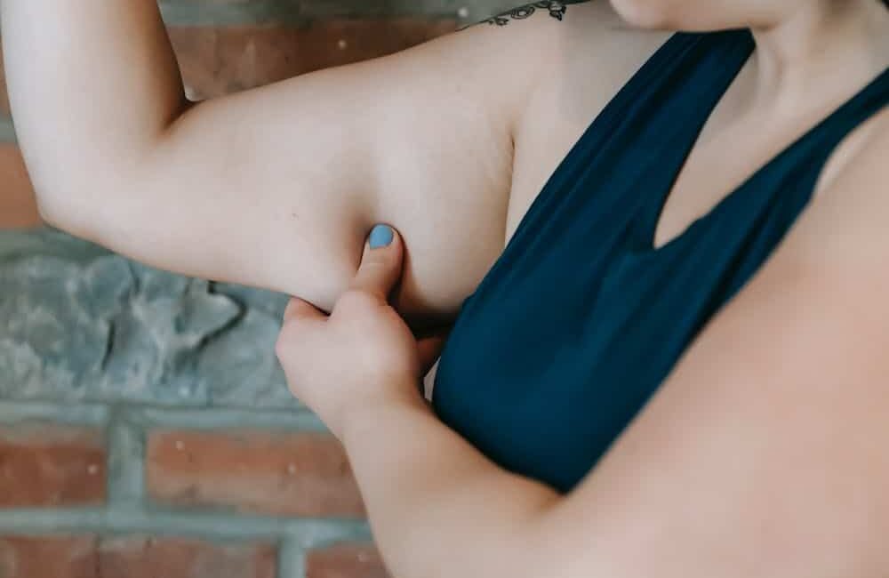 CoolSculpting-Elite-for-Arms_-Say-Goodbye-to-Flabby-Upper-Arms