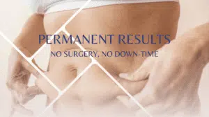 benefits of full body CoolSculpting