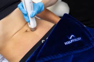 Hero banner RF - Sculptology coolsculpting pics