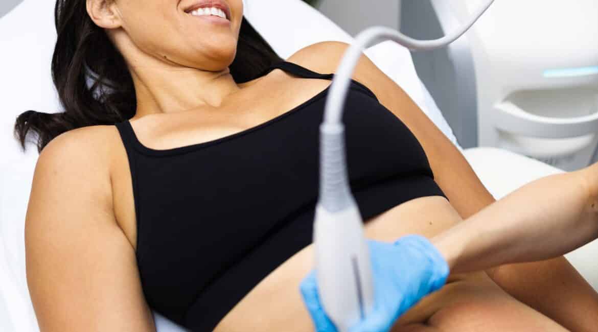 Cryolipolysis for Metamorphosis: The Best CoolSculpting is Your New Ally