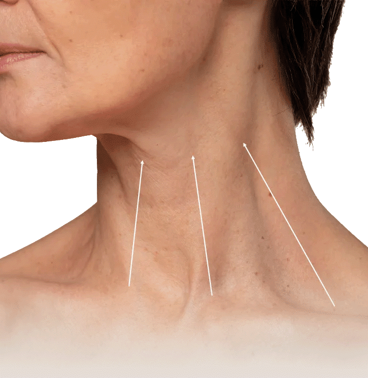 68714de2efdc1e93db10ec15 (1) - Sculptology