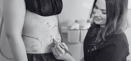 Medical professional marks a pregnant woman’s belly with a marker, drawing guidelines on the skin.